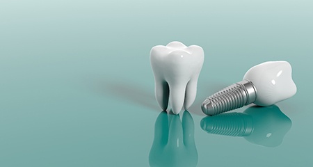 Model tooth next to single tooth dental implant in Gainesville