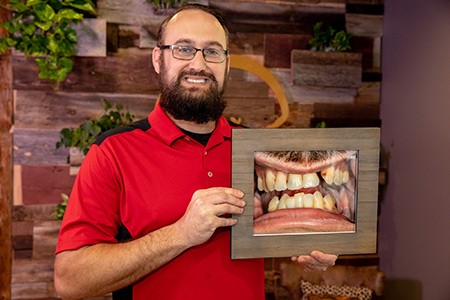 Man holding image of his smile before restorative dentistry treatment