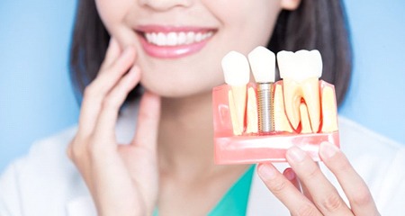 implant dentist in Gainesville holding a model of a dental implant