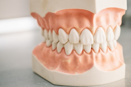 diagram of implant dentures with six implants