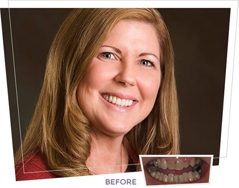 Actual Patient Terri