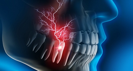 Animated smile with pain radiating from the inside of a tooth in need of root canal therapy