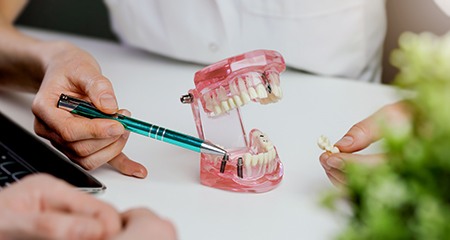 dental implants may fail, but your dentist may be able to help salvage your smile
