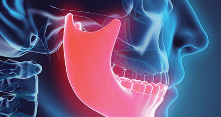 Animation of jaw and skull bone in need of T M J therapy