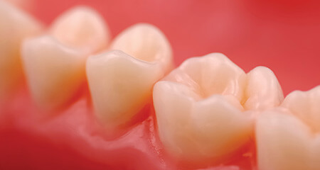 Closeup of flawlessly repaired smile with tooth colored fillings