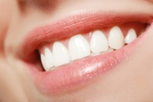 Woman’s teeth with veneers