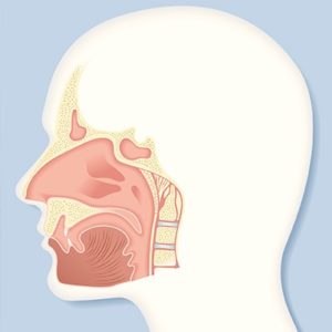 Model of a sinus lift for dental implants