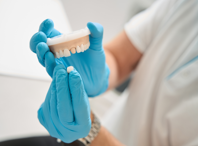 Dentist with model teeth and removable crown
